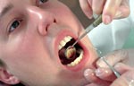 Как ухаживать за зубами